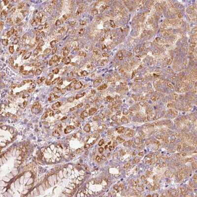 Immunohistochemistry: MTR120 Antibody [NBP2-30819]
