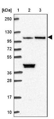Western Blot: MTR120 Antibody [NBP2-30819]