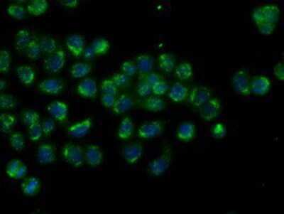 Immunocytochemistry/ Immunofluorescence: MTRF1L Antibody (OTI1D11) [NBP2-02384]