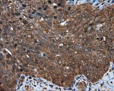 Immunohistochemistry-Paraffin: MTRF1L Antibody (OTI1D11) [NBP2-02384]