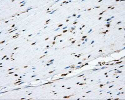 Immunohistochemistry-Paraffin: MTRF1L Antibody (OTI1D11) [NBP2-02384]