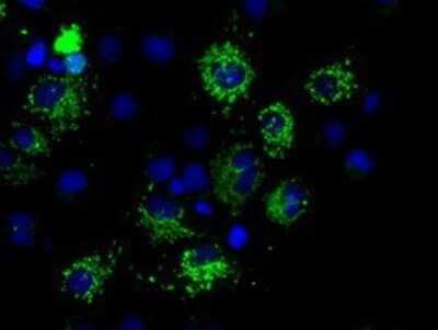Immunocytochemistry/ Immunofluorescence: MTRF1L Antibody (OTI1D11) - Azide and BSA Free [NBP2-72814]