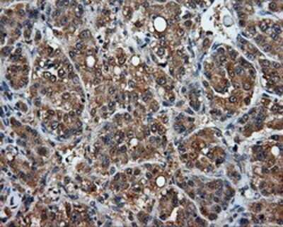 Immunohistochemistry: MTRF1L Antibody (OTI1D11) - Azide and BSA Free [NBP2-72814]