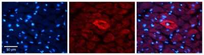 Immunohistochemistry: MTRR Antibody [NBP1-57749]