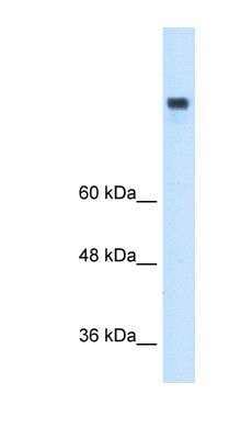 Western Blot: MTTP Antibody [NBP1-62489]