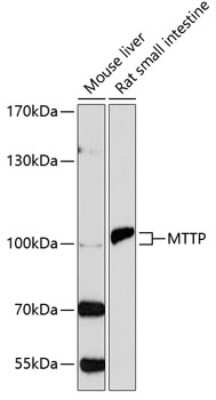 Western Blot: MTTP AntibodyAzide and BSA Free [NBP2-94915]