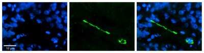 Immunohistochemistry: MTUS1 Antibody [NBP1-60099]