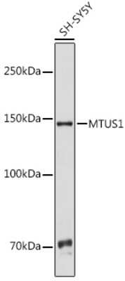 Western Blot: MTUS1 AntibodyBSA Free [NBP3-15462]