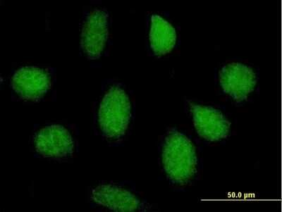 Immunocytochemistry/ Immunofluorescence: MTUS2 Antibody [H00023281-B01P]