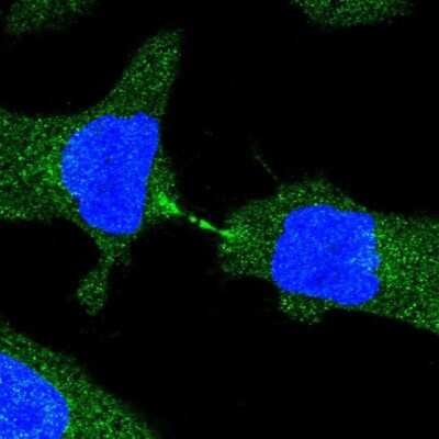 Immunocytochemistry/ Immunofluorescence: MTUS2 Antibody [NBP1-86604]