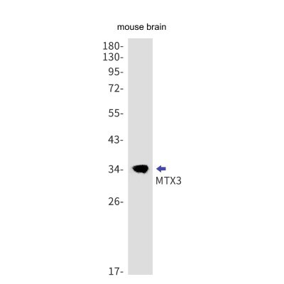 Western Blot: MTX3 Antibody (S08-2K4) [NBP3-19703]