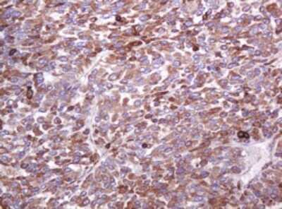 Immunohistochemistry: MUC1 Antibody (OTI2E3) [NBP2-45838]