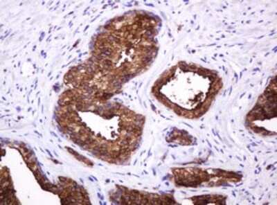 Immunohistochemistry: MUC1 Antibody (OTI2E3) [NBP2-45838]