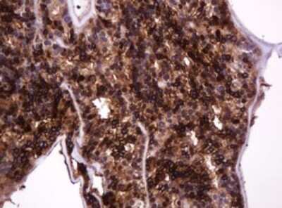 Immunohistochemistry: MUC1 Antibody (OTI2E3) [NBP2-45838]