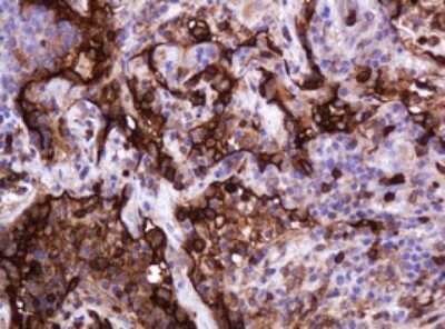 Immunohistochemistry: MUC1 Antibody (OTI2E3) [NBP2-45838]