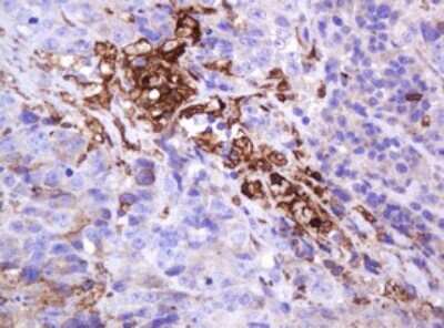 Immunohistochemistry: MUC1 Antibody (OTI2E3) [NBP2-45838]