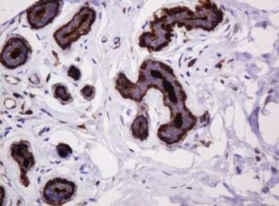Immunohistochemistry: MUC1 Antibody (OTI2E3) [NBP2-45838]