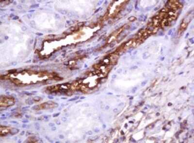 Immunohistochemistry: MUC1 Antibody (OTI2E3) [NBP2-45838]