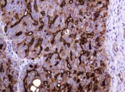 Immunohistochemistry: MUC1 Antibody (OTI2E3) [NBP2-45838]