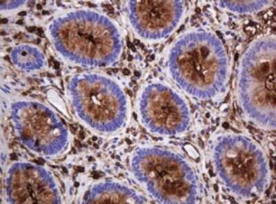 Immunohistochemistry: MUC1 Antibody (OTI2E3) [NBP2-45838]