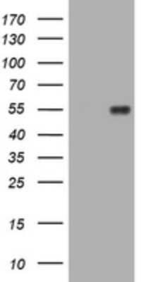 Western Blot: MUC1 Antibody (OTI2E3) [NBP2-45838]
