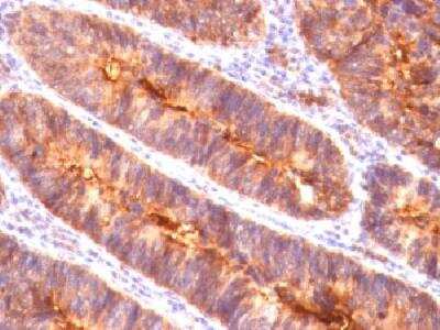 Immunohistochemistry-Paraffin: MUC1 Antibody (MUC1/845) - Azide and BSA Free [NBP2-47881]