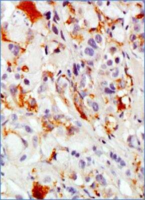 Immunohistochemistry-Paraffin: MUC1 Antibody (SM3) - BSA Free [NB120-22711]