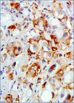 Immunohistochemistry-Paraffin: MUC1 Antibody (SM3) - BSA Free [NB120-22711]