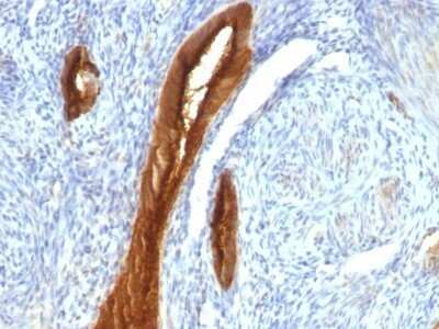 Immunohistochemistry-Paraffin: MUC1 Antibody (139H2) - Azide and BSA Free [NBP2-47888]