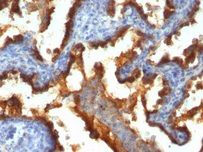 Immunohistochemistry-Paraffin: MUC1 Antibody (139H2) - IHC-Prediluted [NBP2-48378]