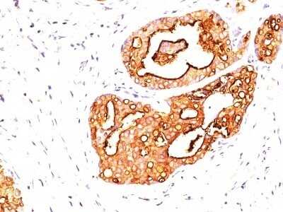 Immunohistochemistry-Paraffin: MUC1 Antibody (139H2) [NBP2-44666]