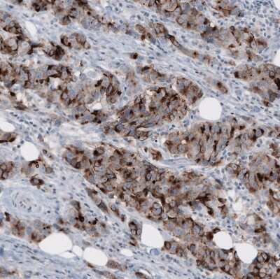 Immunohistochemistry-Paraffin: MUC1 Antibody (CL8733) [NBP3-05503]