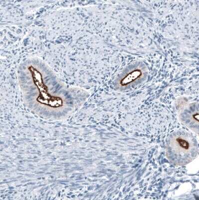 Immunohistochemistry-Paraffin: MUC1 Antibody (CL8733) [NBP3-05503]