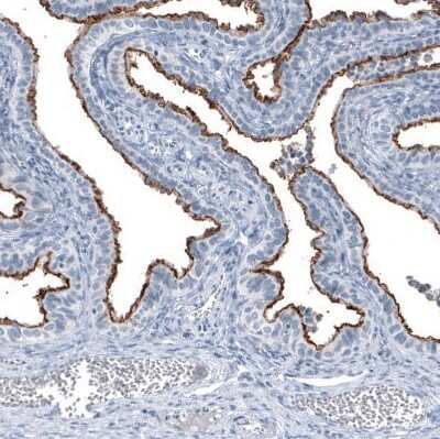 Immunohistochemistry-Paraffin: MUC1 Antibody (CL8733) [NBP3-05503]