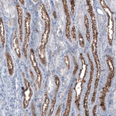 Immunohistochemistry-Paraffin: MUC1 Antibody (CL8733) [NBP3-05503]