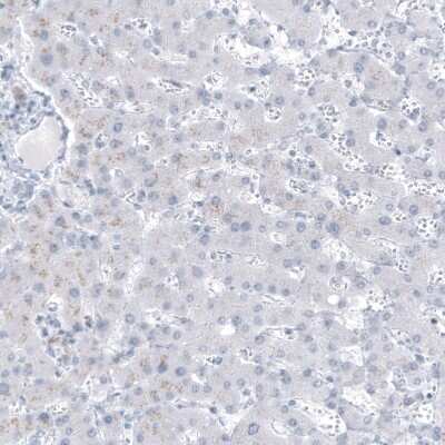 Immunohistochemistry-Paraffin: MUC1 Antibody (CL8733) [NBP3-05503]