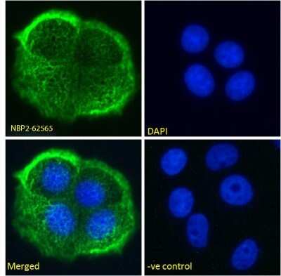 Immunofluorescence: MUC1 Antibody (HMFG2) - Chimeric - Azide and BSA Free [NBP2-62565]