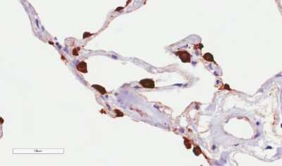 Immunohistochemistry-Paraffin: MUC1 Antibody (HMFG2) - Chimeric - Azide and BSA Free [NBP2-62565]