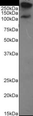 Western Blot: MUC1 Antibody (HMFG2)ChimericAzide and BSA Free [NBP2-62565]