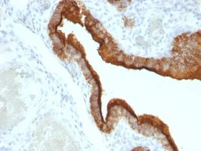 Immunohistochemistry-Paraffin: MUC1 Antibody (HMPV) [NBP2-44657]