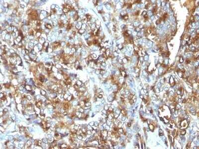 Immunohistochemistry-Paraffin: MUC1 Antibody (MUC1/520) - Azide and BSA Free [NBP2-47886]