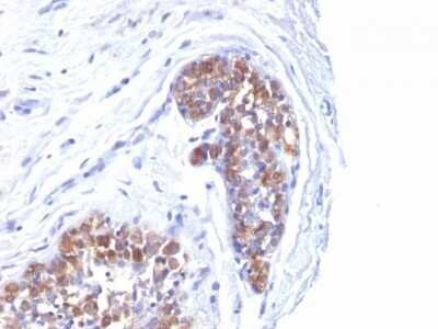 Immunohistochemistry-Paraffin: MUC1 Antibody (MUC1/520) - Azide and BSA Free [NBP2-47886]