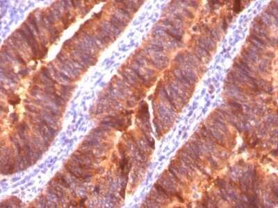 Immunohistochemistry-Paraffin: MUC1 Antibody (MUC1/520) - Azide and BSA Free [NBP2-47886]