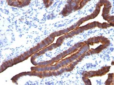 Immunohistochemistry-Paraffin: MUC1 Antibody (MUC1/520) - IHC-Prediluted [NBP2-48375]