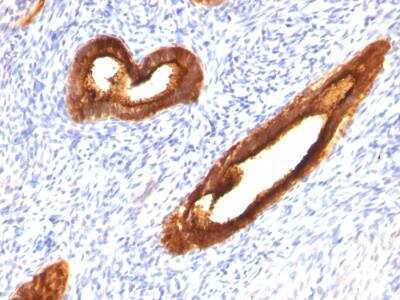 Immunohistochemistry-Paraffin: MUC1 Antibody (MUC1/520) - IHC-Prediluted [NBP2-48375]
