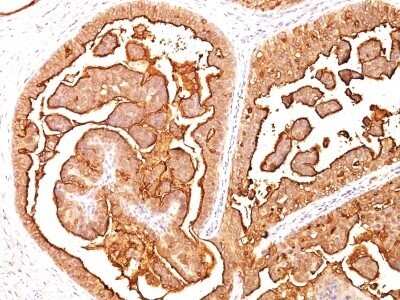 Immunohistochemistry-Paraffin: MUC1 Antibody (MUC1/520) [NBP2-44660]