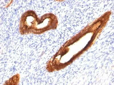 Immunohistochemistry-Paraffin: MUC1 Antibody (MUC1/520) [NBP2-44660]
