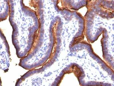 Immunohistochemistry-Paraffin: MUC1 Antibody (MUC1/845) - IHC-Prediluted [NBP2-48377]