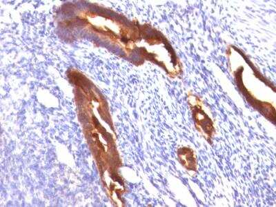 Immunohistochemistry-Paraffin: MUC1 Antibody (MUC1/845) - IHC-Prediluted [NBP2-48377]