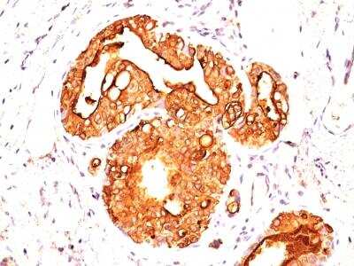 Immunohistochemistry-Paraffin: MUC1 Antibody (MUC1/845) - IHC-Prediluted [NBP2-48377]